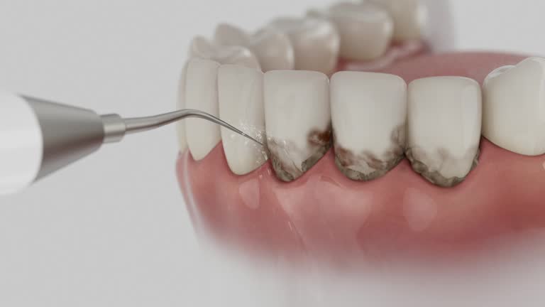 Reliable Dental Implants contractor in Great Neck Estates, NY by Smile Center Dentistry